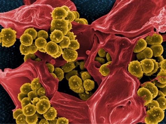 Microscopic image of a virus